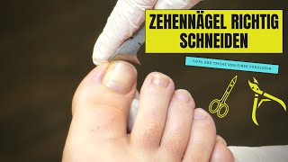 ZEHENNÄGEL RICHTIG SCHNEIDEN  So geht es richtig [upl. by Arnie]