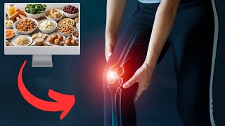 Best And Worst Foods For Arthritis Pain  What To Eat [upl. by Indys]