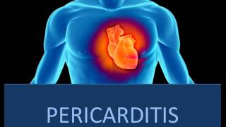 Pericarditis  Fisiopatología [upl. by Euhc]