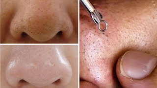 How To Do Facial Clean Up At Home Step By Step For Spotless Clear Skin Rabia Skincare [upl. by Bamberger205]