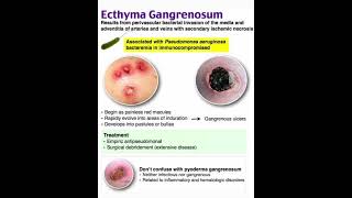 Ecthyma gangrenosum [upl. by Katonah]