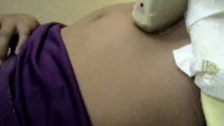 Sonogram Pregnancy 13 weeks  Embarazo 13 semanas [upl. by Hgielek259]