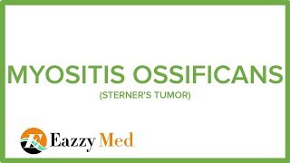 MYOSITIS OSSIFICANS STERNERS TUMOR [upl. by Selbbep57]