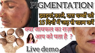 pigmentation Treatment At Home l जायफल से झाइयों को खत्म करें l pigmentation kaise thik kare 🤔 [upl. by Howarth499]