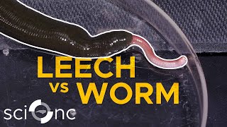 Watch this giant leech eat an earthworm [upl. by Izawa]