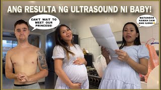 DAHIL MALAPIT NA AKO MANGANAK EVERY 2 WEEKS NA AKONG MY CHECK UP MAKAKARAOS DIN AKO [upl. by Aicined]