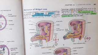 Mid gut Development and Rotation  Alimentary System Part 7 [upl. by Einafats113]