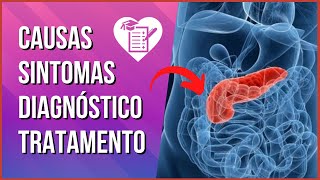 PANCREATITE  Causas Sintomas e Tratamento [upl. by Enelrad]