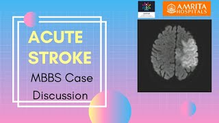 MBBS Case Presentation  Acute Stroke [upl. by Penn]