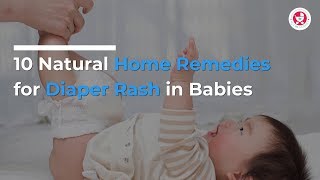 10 Natural Home Remedies for Diaper Rash in Babies [upl. by Aidne]