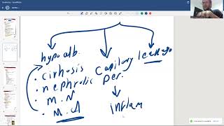 شرح ال ascites كامله [upl. by Tobi653]