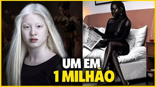 10 Pessoas Únicas e Raras que são Uma em Um MILHÃO [upl. by Ateinotna]