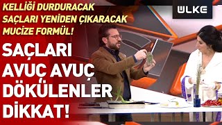 Saçları dökülenler dikkat Kelliği durduracak saçlarınızı yeniden çıkaracak mucize formül [upl. by Inat]