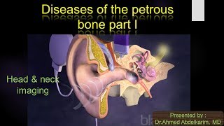 5pathology of the petrous bone I [upl. by Ennaeilsel]