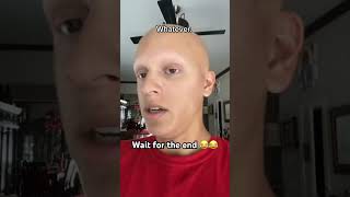 WAIT FOR THE END 😂😂 comedy funny alopecia relatable [upl. by Kleinstein910]