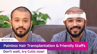 Painless Hair Transplantation amp friendly staffs  Dont wait try Cutis now [upl. by Mordy807]