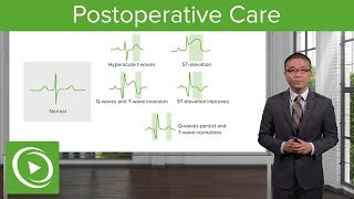 Postoperative Care – Surgery  Lecturio [upl. by Belle]