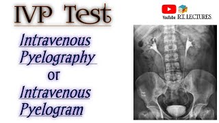 IVP testIntravenous Pyelography IVUIntravenous Urographytest Excretoru Urography test complte [upl. by Cutlip]