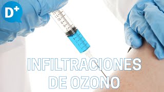 ¿Qué son las infiltraciones de ozono [upl. by Eirehs]