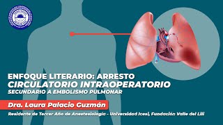 Webinar Enfoque Literario Arresto Circulatorio Intraoperatorio Secundario a Embolismo Pulmonar [upl. by Nohtiek609]