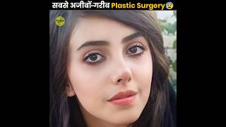 सबसे अजीबोगरीब Plastic Surgeries 😰  Plastic Surgery Gone Wrong  The Fact  shorts ytshorts [upl. by Eiramassenav]