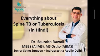 Spinal Tuberculosis and its treatment  Dr Saurabh Rawall MBBS AIIMS MS Ortho AIIMS in HINDI [upl. by Lennie]