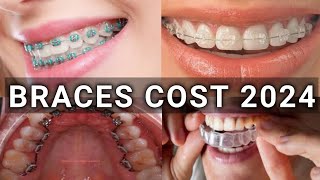 Braces Type amp Treatment Cost 2024  Metal vs Ceramic vs Lingual vs Invisalign Braces  Latest [upl. by Ewolram]