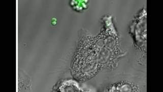 Phagocytosis of MRSA by a human neutrophil [upl. by Rezal980]