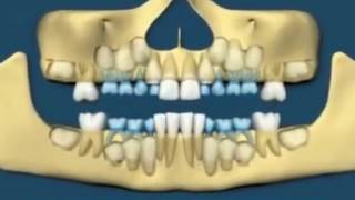 MANTRA TO REGROW TEETH [upl. by Nioe]