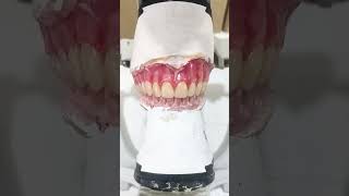 Montagem PT superior com dentes Trilux protesedentaria [upl. by Caasi]