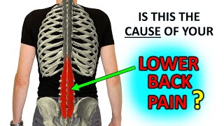 Recurrent Lower Back Pain The Research Says… Do This [upl. by Georgi425]