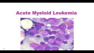 Introduction to Acute myeloid leukemia 2022 [upl. by Ecirtaemed886]