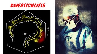 DIVERTICULITIS EXPLAINED [upl. by Annora]