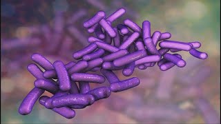 What doctors say you need to know about Shigella the drugresistant stomach bug causing concerns [upl. by Aniela875]