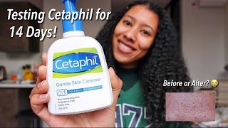 I Used Cetaphil Cleanser for 14 Days uk [upl. by Ocram7]