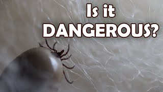 How TICKS are hurting sheep farms [upl. by Gaultiero923]