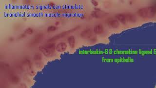 changes in bronchiole epithelia in asthma [upl. by Asenav492]