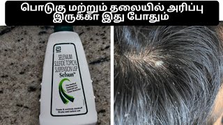 selsun shampoo for dandruff review in tamil  anti dandruff shampoo itchy scalp [upl. by Nosreip]