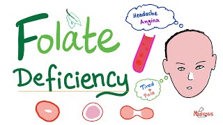 Folate deficiency  Megaloblastic Anemia  Macrocytic  Hematology Series [upl. by Notsgnik]