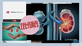 RENAL PATHOLOGY lecture 14 DRUD INDUCED TUBULOINTERSTITIAL NEPHRITIS [upl. by Ainahs]