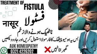 Treatment of Fistulaفیٹولا na thk hony wala zakham yeh video dekhein or jado dekhein AUK Homeopathy [upl. by Amalia651]