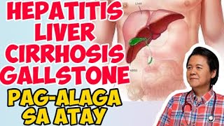 Hepatitis Liver Cirrhosis Gallstone PagAlaga sa Atay  ni Doc Willie Ong 454b [upl. by Mahtal]