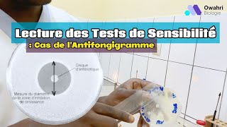 Comment Analyser un Antibiogramme  Tutoriel de Lecture des Tests de Sensibilité [upl. by Aihcrop]