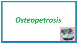 OsteopetrosisMarble bone disease  Important Notes  Diseases of Bone and Joint 1  Oral Pathology [upl. by Notselrahc]