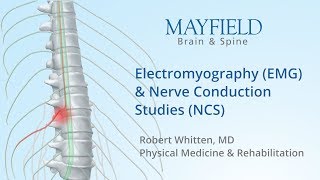 Electromyography EMG amp Nerve conduction studies NCS [upl. by Ovid758]