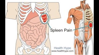 spleen injury  splenic injury  spleen injury causes  signssymptoms [upl. by Leonor767]