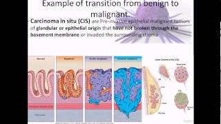 Pathophysiology 17 Cancer overview [upl. by Aicercal]