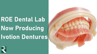 ROE Dental Lab Now Producing Ivotion Dentures [upl. by Hildegaard792]