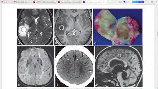 NEURORADIOLOGY CORE REQUISITES [upl. by Virgie]