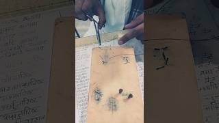 Bams students 👨‍⚕️Life  Figure of 8  Suturing practice ayurveda bams internship mbbs [upl. by Remsen]